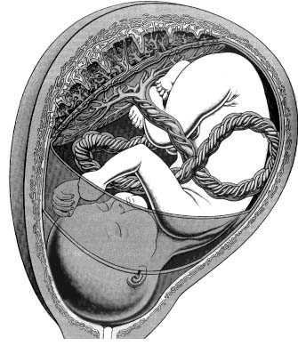 Fetal Monitoring and Labor